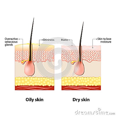 Oily & dry skin Vector Illustration