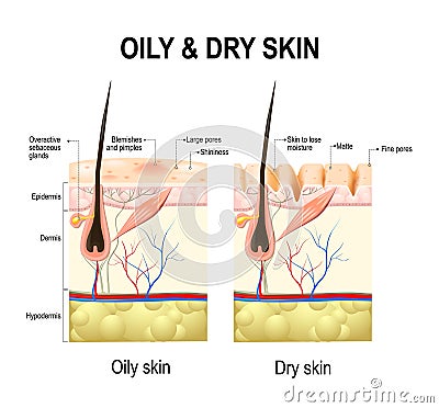 Oily and dry skin Vector Illustration