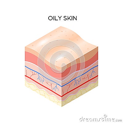 Oily skin cross-section of human skin layers structure skincare medical concept flat Vector Illustration