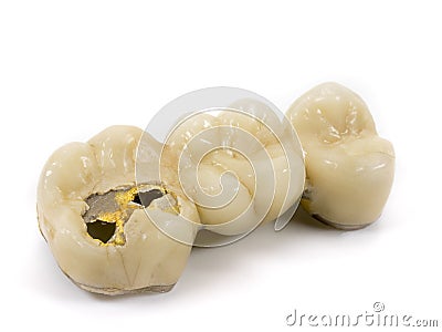 Old dental gold Stock Photo