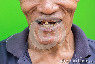 Old man smiling showing his teeth unattractive on green background. Stock Photo