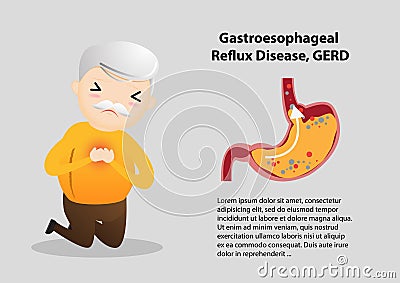 Gastro-Esophageal Reflux Disease GERD Vector Illustration