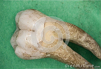 Old molars of humans Stock Photo