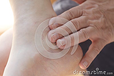 Older man has painful ankle Stock Photo