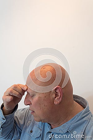 Older man head in profile hand to forehead, headache, bald, alopecia, chemotherapy, cancer Stock Photo