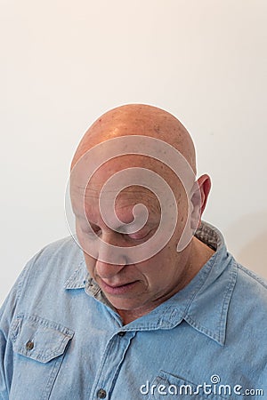 Older man looking down, bald, alopecia, chemotherapy, cancer Stock Photo