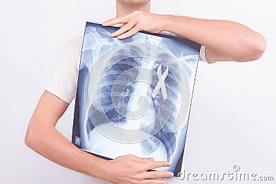 Oncological lung cancer disease concept Stock Photo