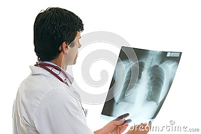 Oncologist with chest x-ray Stock Photo