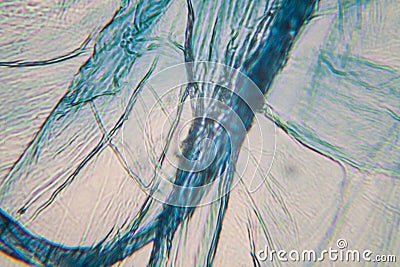 Onion cells at the microscope Stock Photo