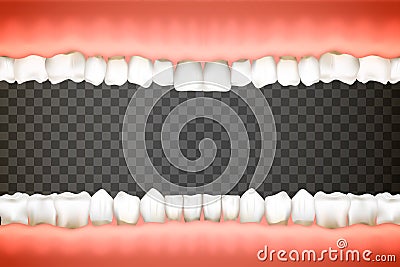 Open human mouth with jaws full of realistic teeth in pink gums on transparent background Vector Illustration