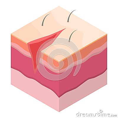 Open surgical suture icon, isometric style Vector Illustration