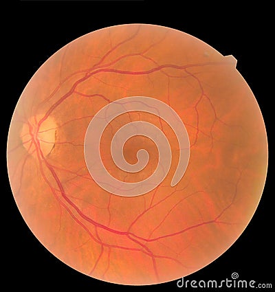 Ophthalmic image detailing the retina and optic nerve inside a healthy human eye. Health protection concept Stock Photo