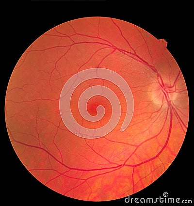 Ophthalmic image detailing the retina and optic nerve inside a healthy human eye. Medicine concept Stock Photo