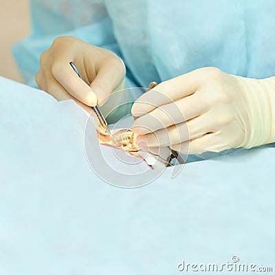 Ophthalmology laser microscope operation. Doctor in clinic. Patient eye treatment. Myopia and cataract removal Stock Photo