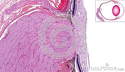 Optic nerve and retina Stock Photo