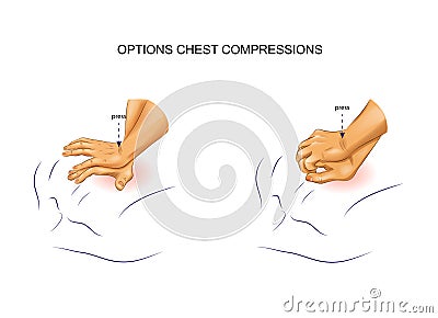 Options for indirect heart massage Vector Illustration