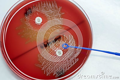 Optochin subsensitivity test on blood agar plate contains small Stock Photo