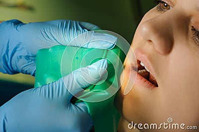 Oral procedure Stock Photo