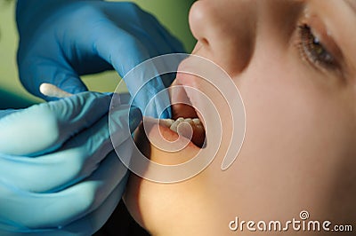 Oral procedure Stock Photo