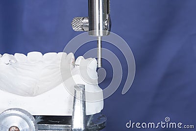 Oral rehabilitation process, partial removable prosthesis Stock Photo