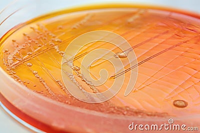 Orange bacteria Stock Photo