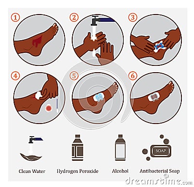 How to apply common first aid situation Stock Photo