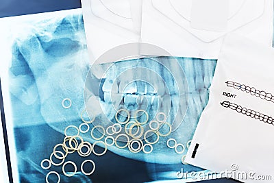 Orthodontic teeth braces latex rubber rings, xray Stock Photo