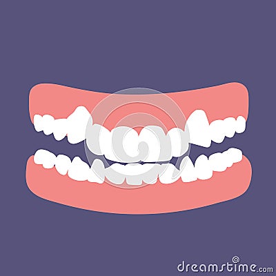 Orthodontic teeth problem crowding. Abnormal eruption. Double tooth Vector Illustration