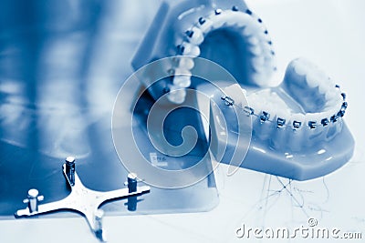 Orthodontic tools Stock Photo