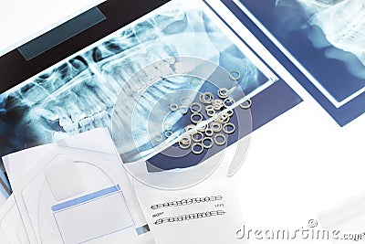 Orthodontic tools and xray on the table Stock Photo