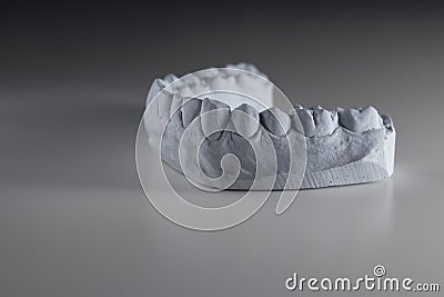 Dental health concept. Plaster copy of the jaw of a person. Stock Photo