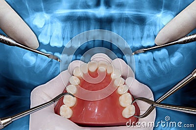 Orthodontics tools surgery simulation Stock Photo