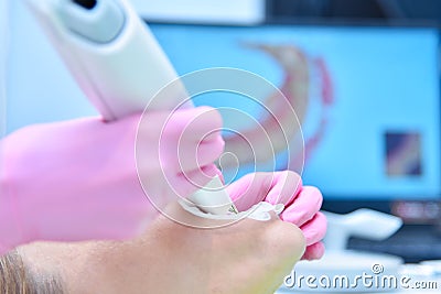Orthodontist scaning patient with dental intraoral 3d scanner Stock Photo