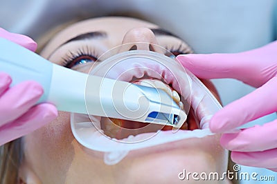Orthodontist scaning patient with dental intraoral 3d scanner Stock Photo