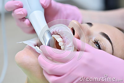 Orthodontist scaning patient with dental intraoral scanner Stock Photo