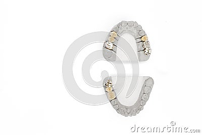 Orthopedic dentistry background. dental prosthetics background. concept of artificial teeth Stock Photo