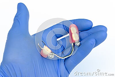 orthopedic dentistry. removable prosthetics. prosthetics with clasp prostheses. removable lower jaw prosthesis Stock Photo