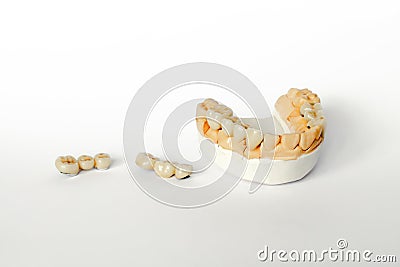 Orthopedic dentistry. tooth replacement concept. dental prosthetics. cermet teeth. ceramic bridges Stock Photo