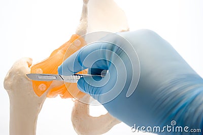 Orthopedic surgery concept photo. Doctor keeps in gloved hand scalpel near anatomic model of human hip joint. Idea of photo for or Stock Photo