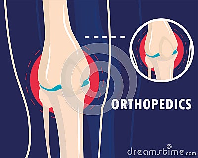 orthopedics rheumatism arthritis Vector Illustration