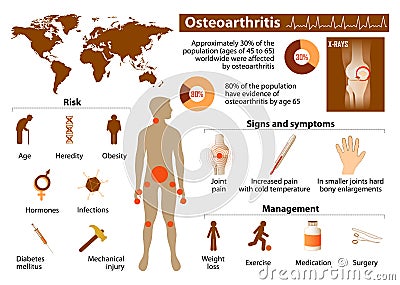 Osteoarthritis Vector Illustration