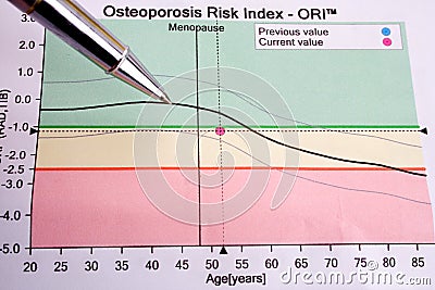 Osteoporosis Stock Photo