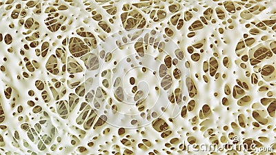 Osteoporosis advanced -high details - Stage 4 - 3d rendering Stock Photo