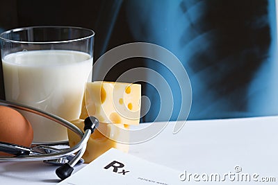 Osteoporosis calcium dairy product and x-ray photo Stock Photo