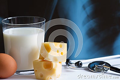 Osteoporosis calcium dairy product and x-ray photo Stock Photo