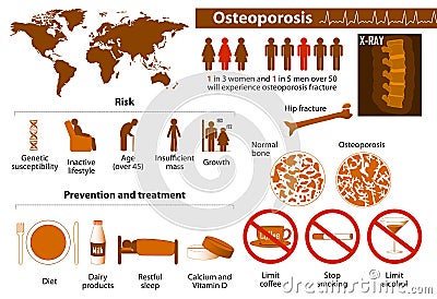 Osteoporosis infographic Vector Illustration