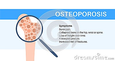 Osteoporosis medical poster Vector Illustration