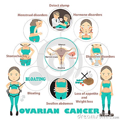 Ovarian cancer Vector Illustration