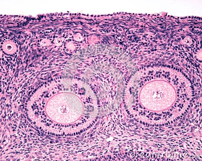 Ovarian cortex. Seconday follicles Stock Photo