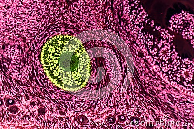 Ovarian follicles. Light microscopy Stock Photo